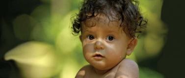 Child Health Equity Research Fellowship